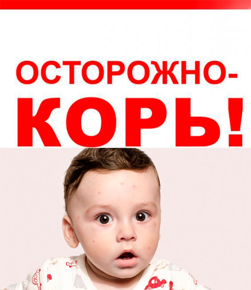 Осторожно! Корь!.